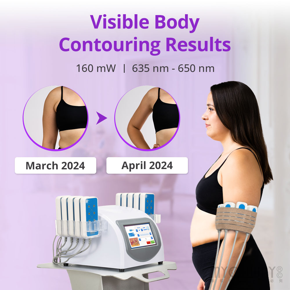 160mw lipo laser slimming machine body shaping 14 pads weight loss laser device