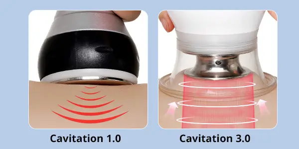 What Is A Cavitation 3.0 Machine? Does It Work For Weight Loss?
