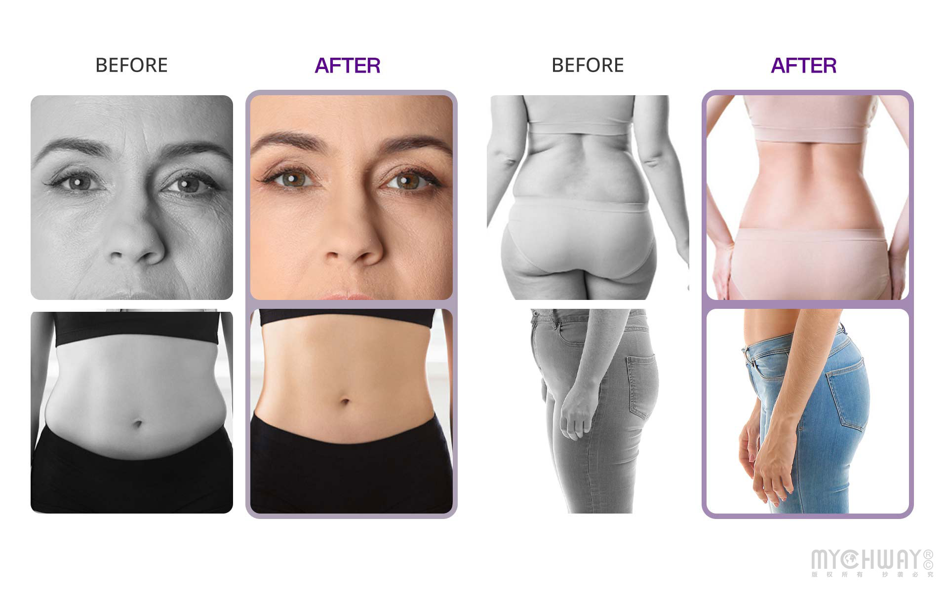 professional cavitation 2.0 3d radio frequency cellulite removal slimming beauty machine
