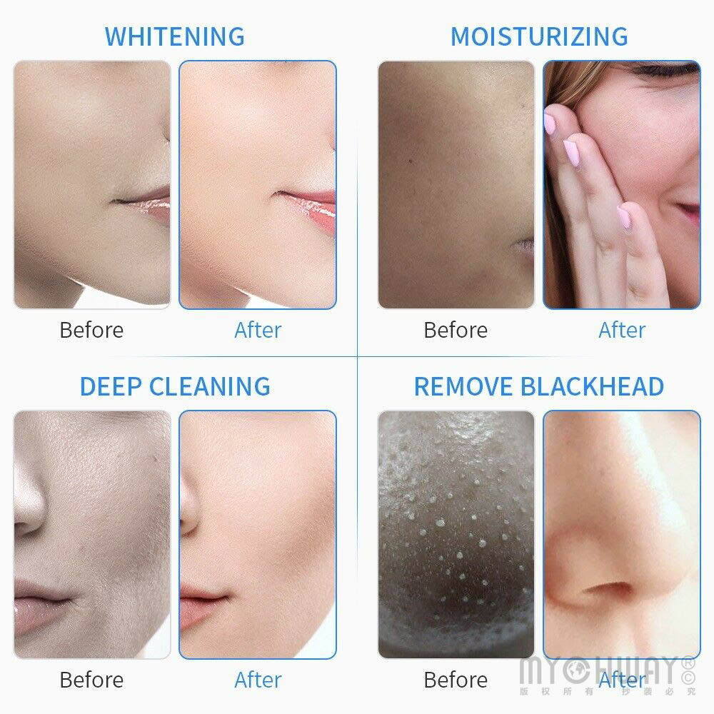 6 in 1 facial hydro dermabrasion beauty machine