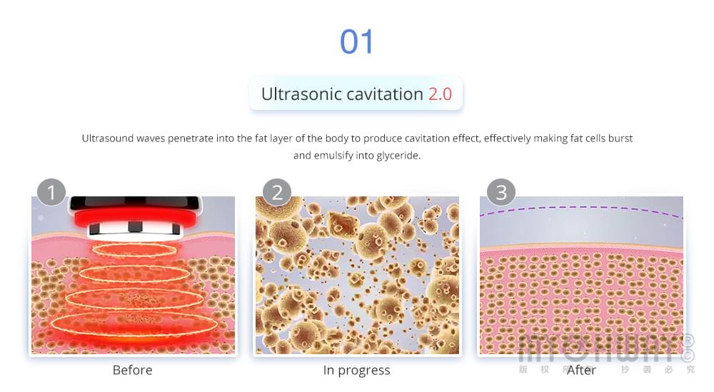 ultrasonic cavitation 2.0