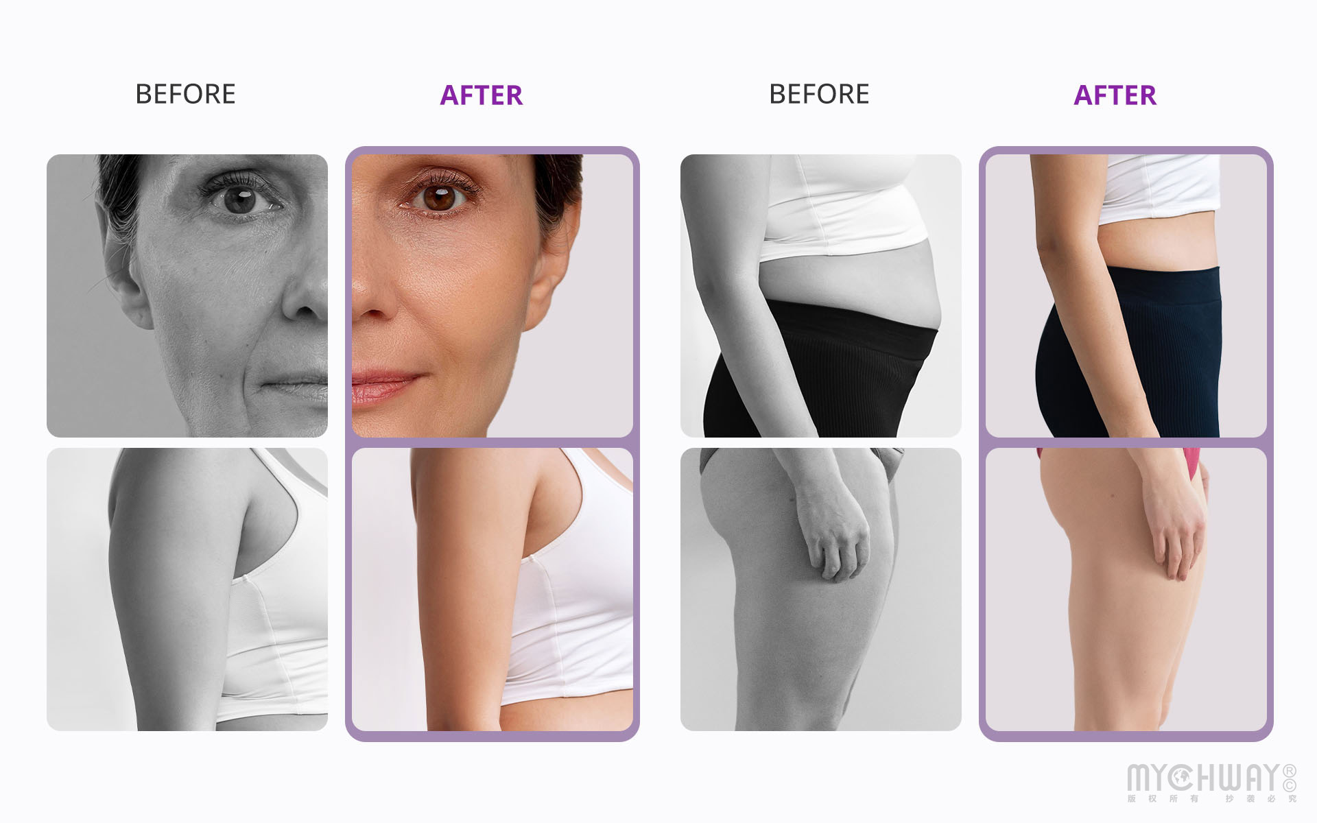 aristorm ultrasonic cavitation machine for at home body sculpting facial anti aging
