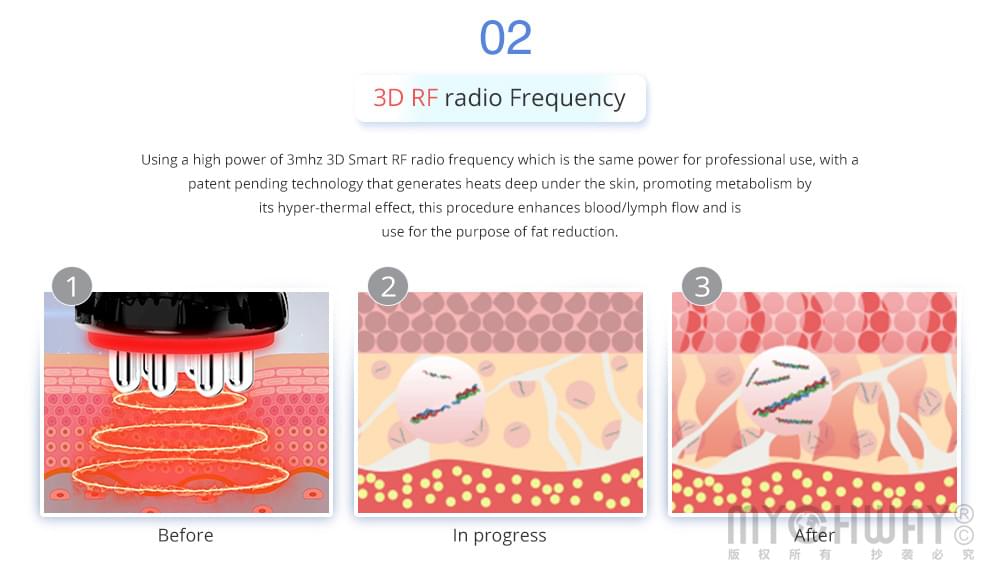 3d rf radio frequency 