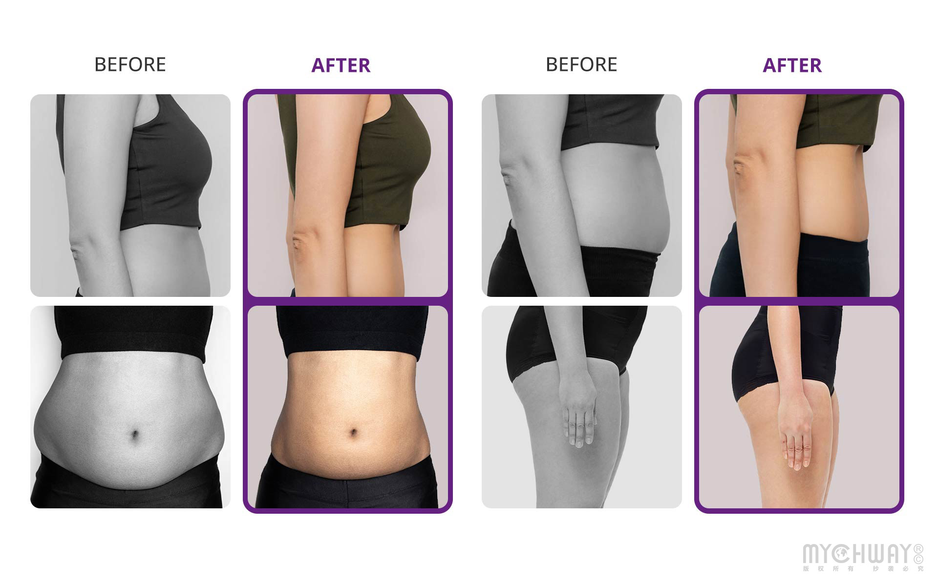 60k cavitation 2.5 ultrasound ultrasonic weight loss body machine