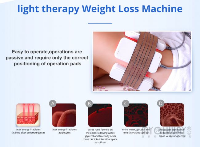 laser energy weight loss