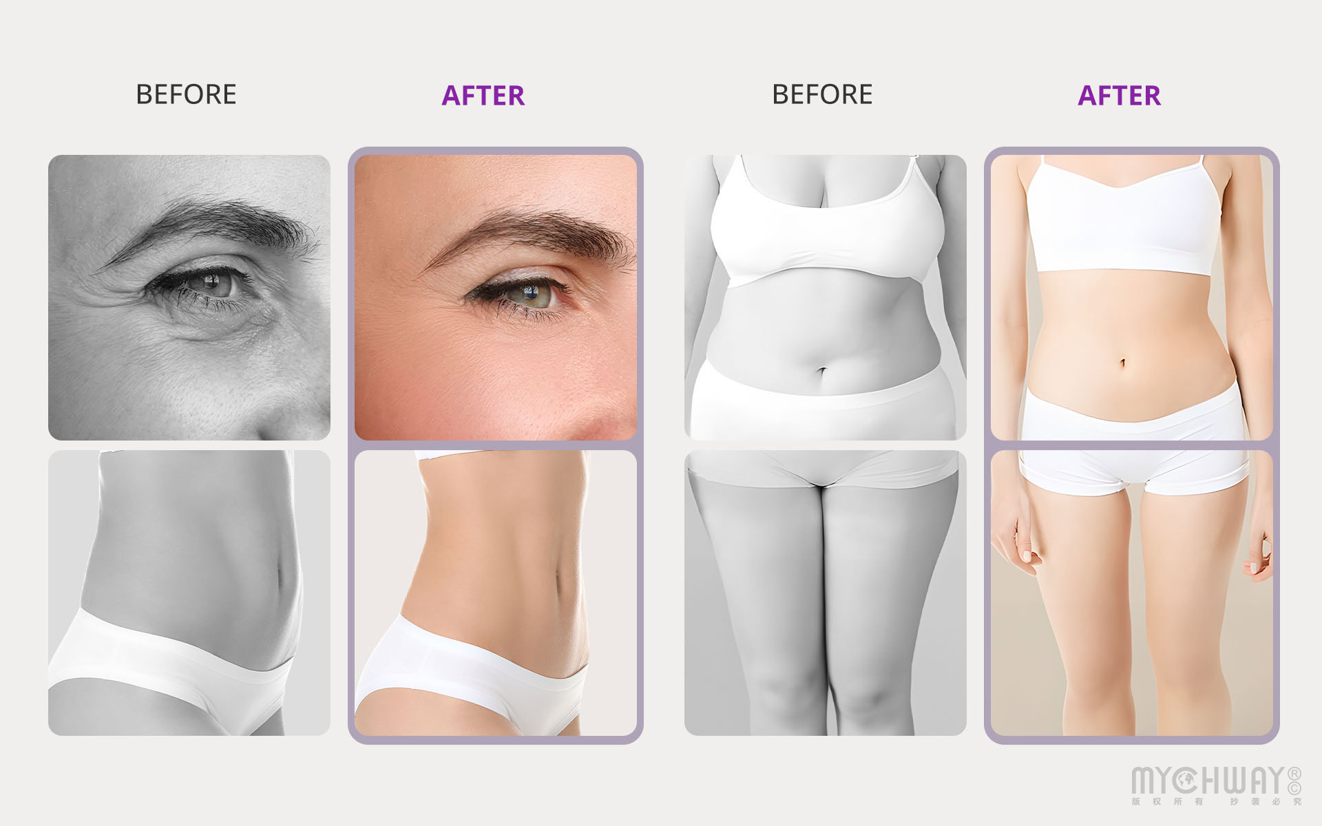 aristorm 10in1 cavitation machine body sculpting rf facial skin care for beauty studio