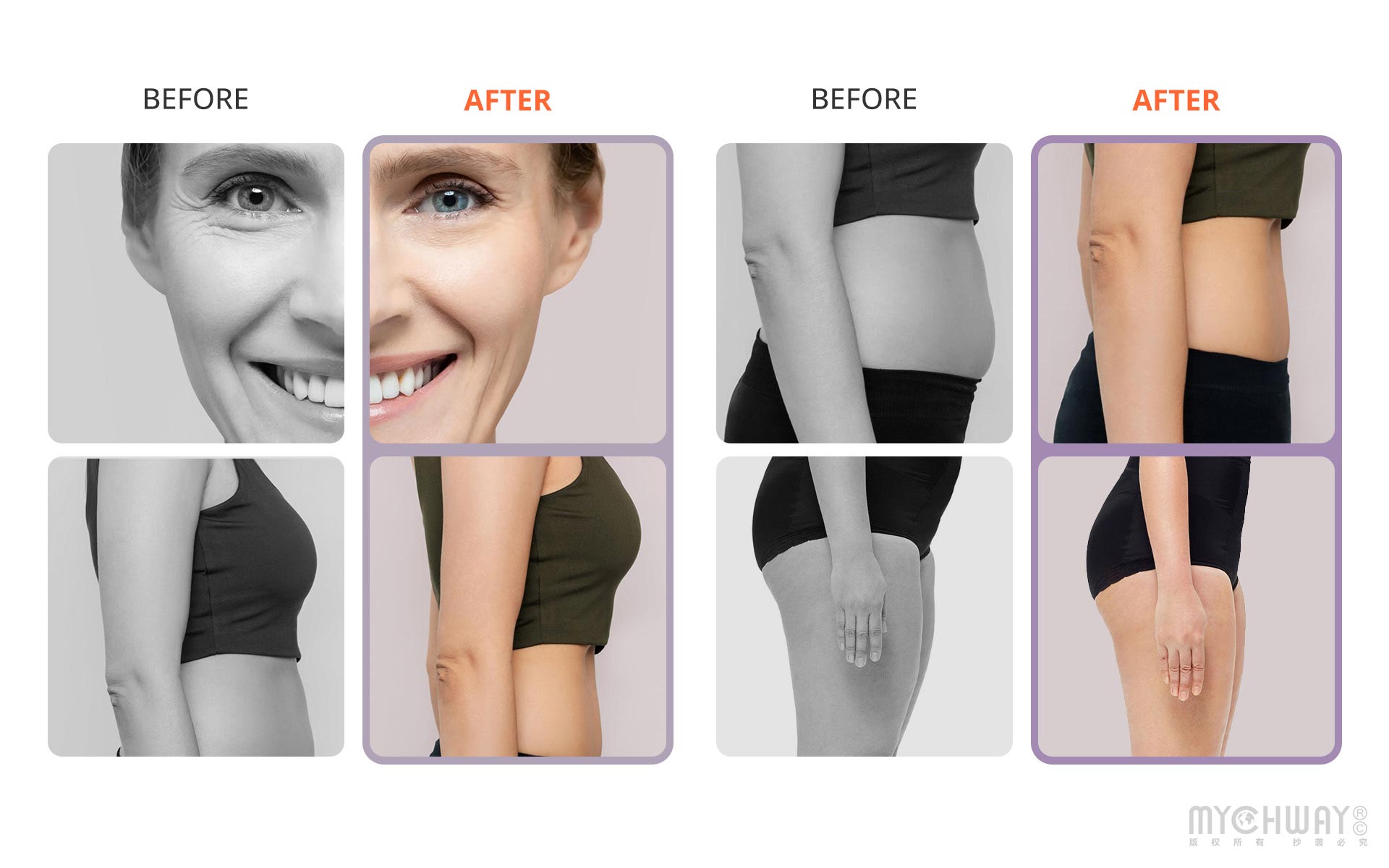 aristorm s shape 30k cavitation body shaping machine