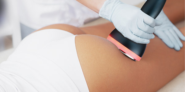 Can you freeze your belly fat at home?