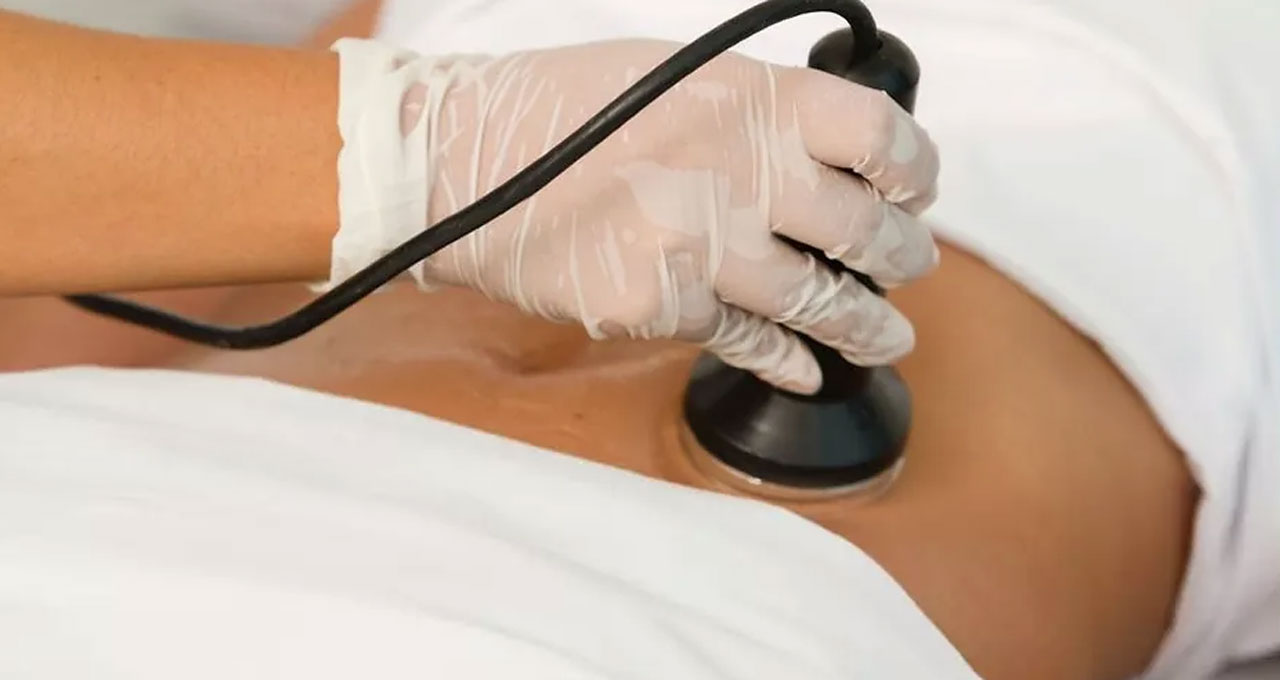 How to Choose the Right Cavitation Machine for Your Needs