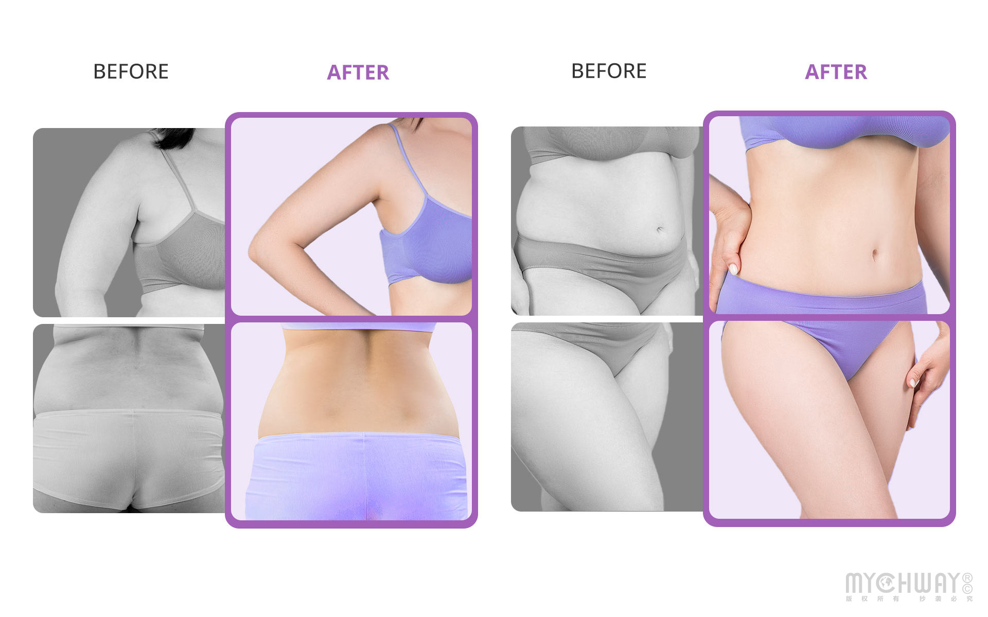 new cavitation 2.5 body shaping beauty machine for home use