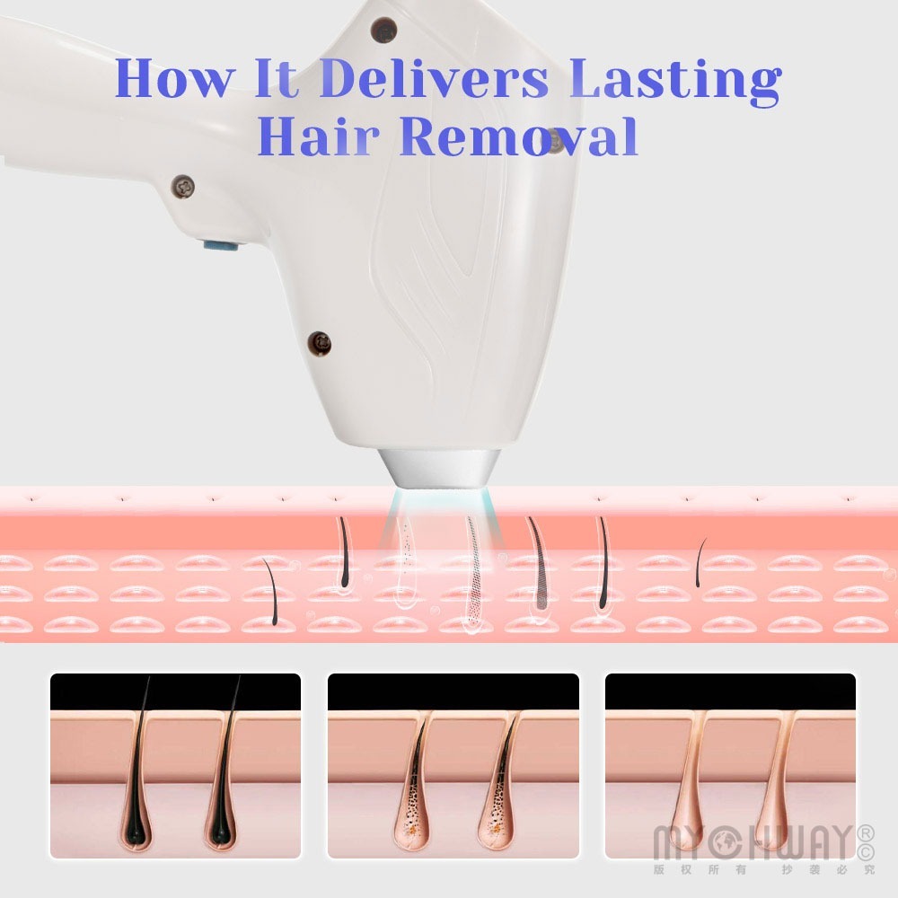 2 in1 dpt 808nm diode hair removal yag laser tattoo removal machine