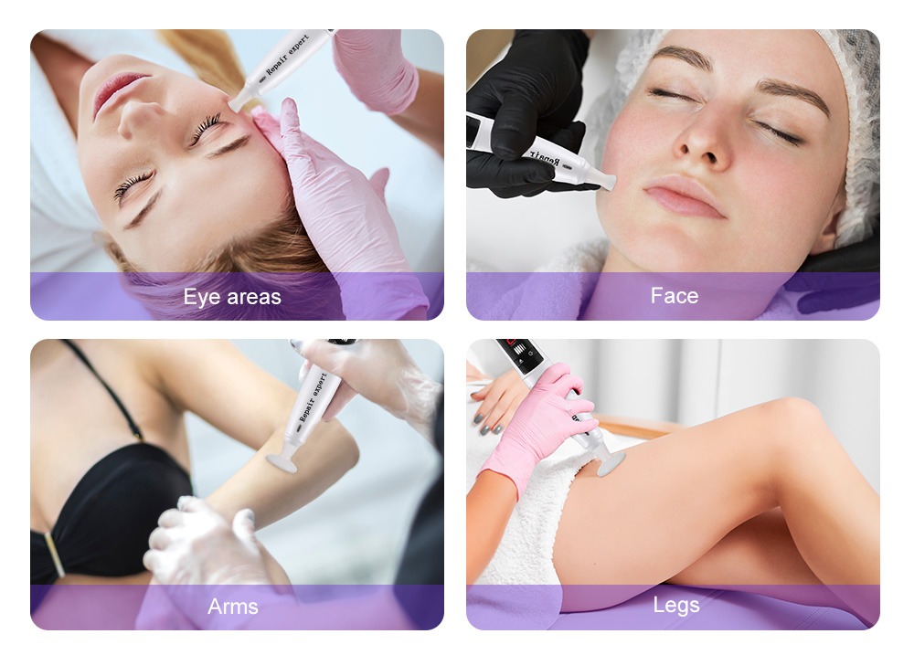 2 in 1 plasma beauty machine facial lifting spot removal skin firming
