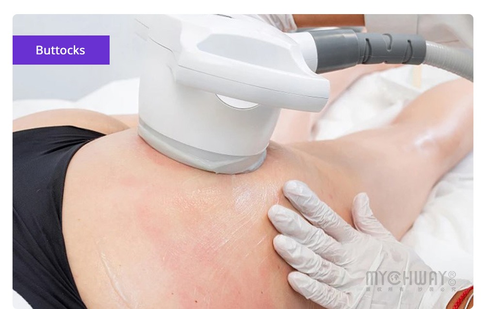 professional 4 in 1 rf machine body massage 40k vacuum vela slimming machine