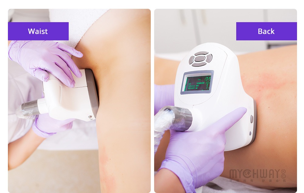 professional 4 in 1 rf machine body massage 40k vacuum vela slimming machine