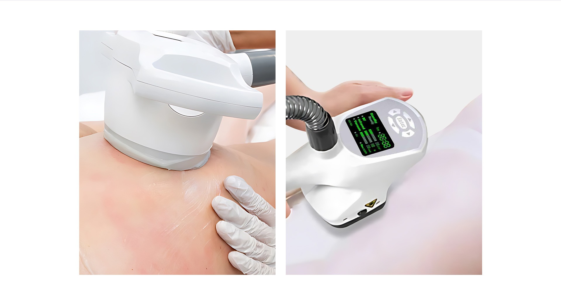 360 degree rotate roller massage beauty vacuum roller body sculpting machine