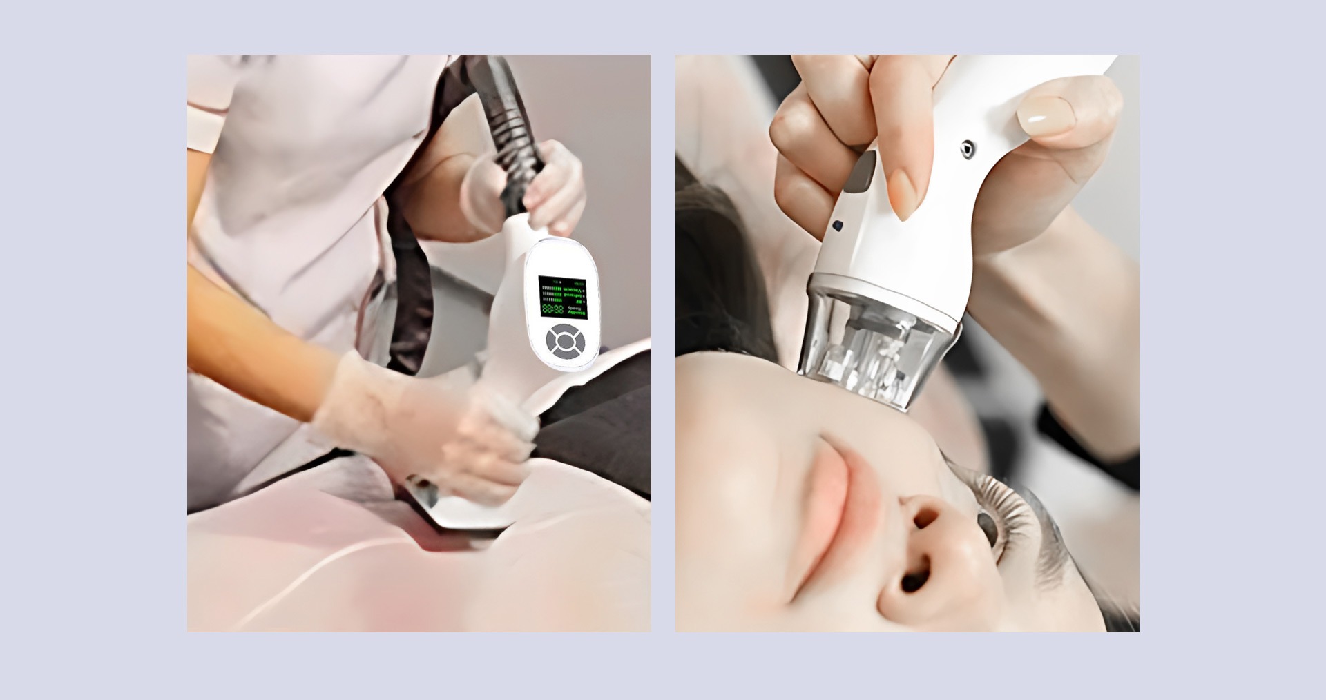 360 degree rotate roller massage beauty vacuum roller body sculpting machine
