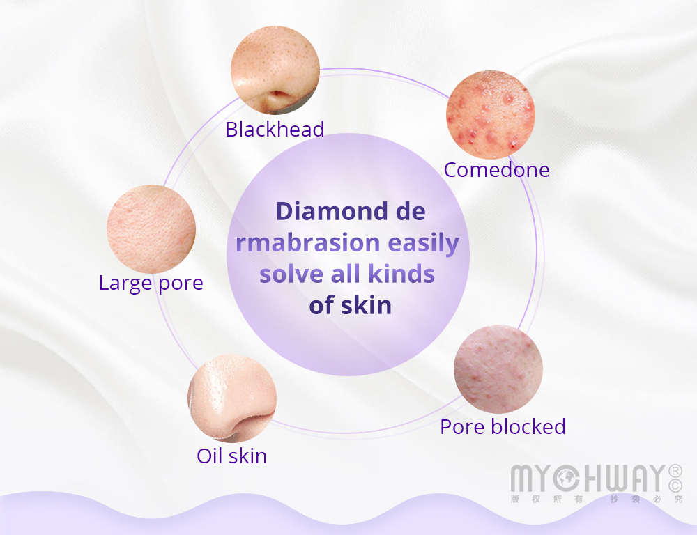 diamond microdermabrasion blackhead removal machine professional for home use