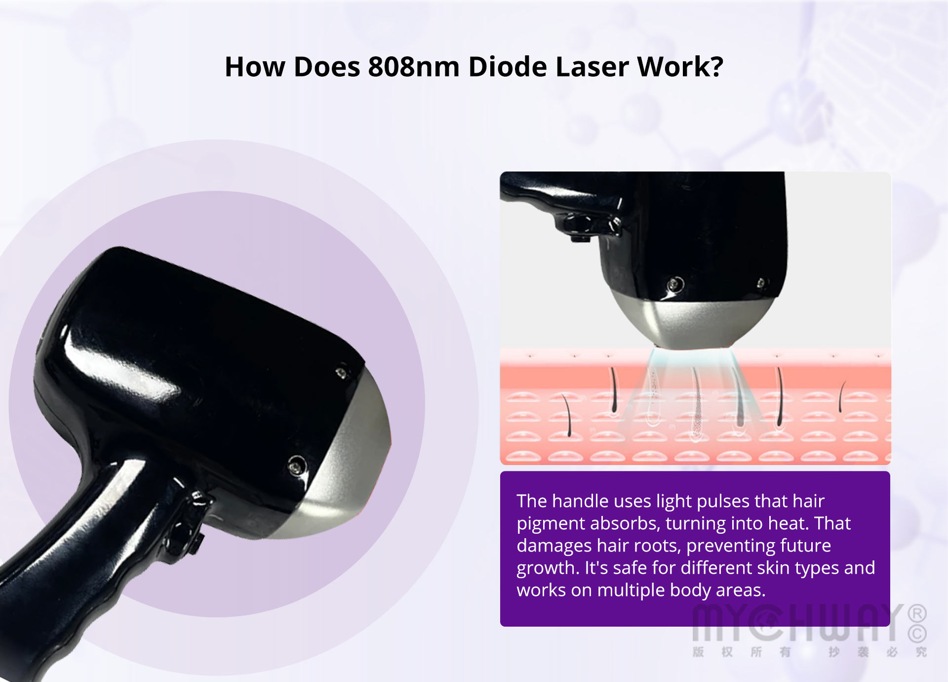 808nm diode laser hair removal machine for permanent painless hair removal