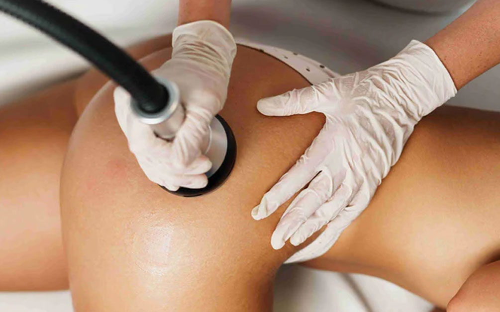 Top 7 Best 30k Cavitation Machines for Sale (2025)