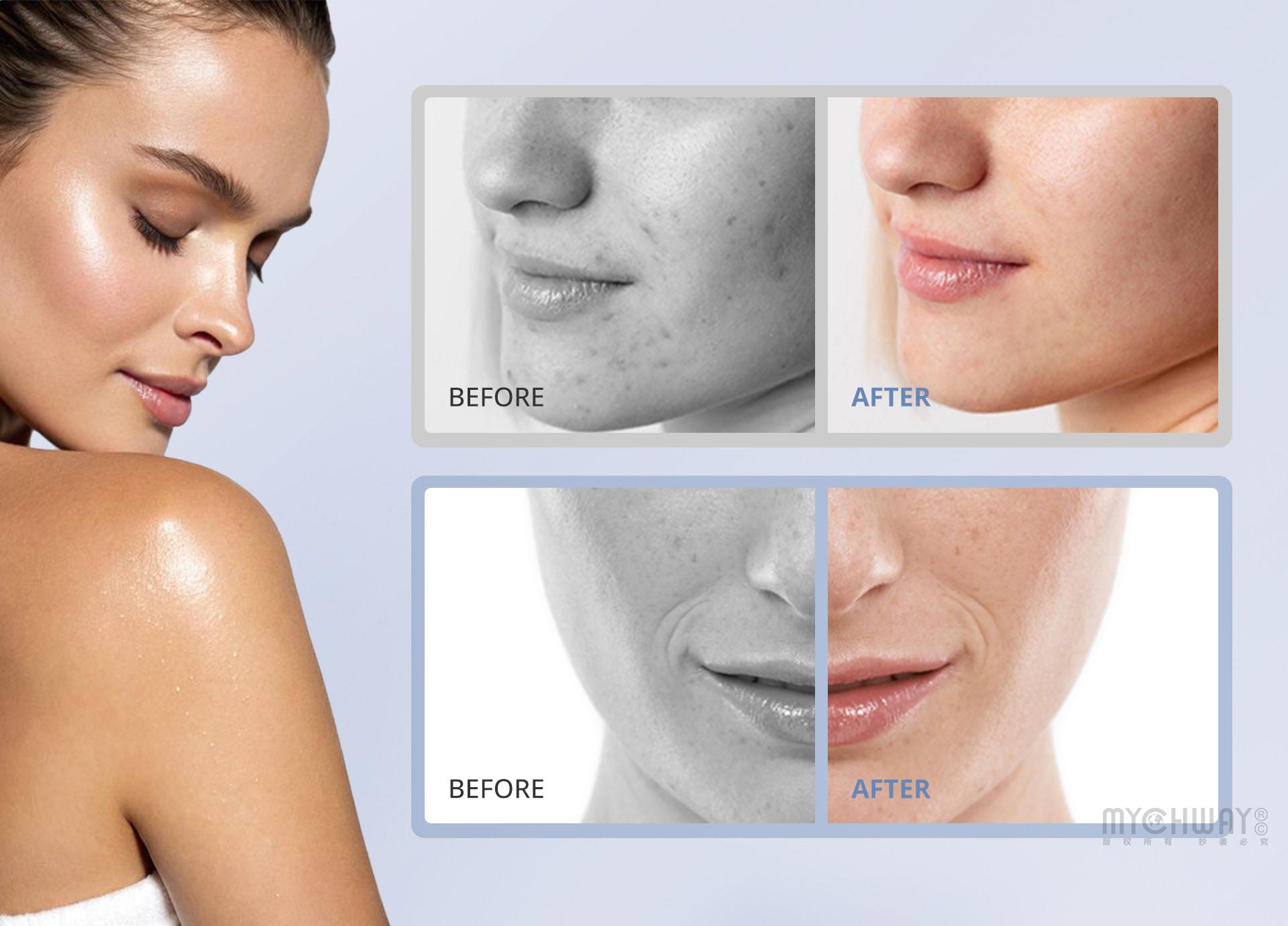 3 in 1 diamond microdermabrasion machine for exfoliation, cleansing, hydration